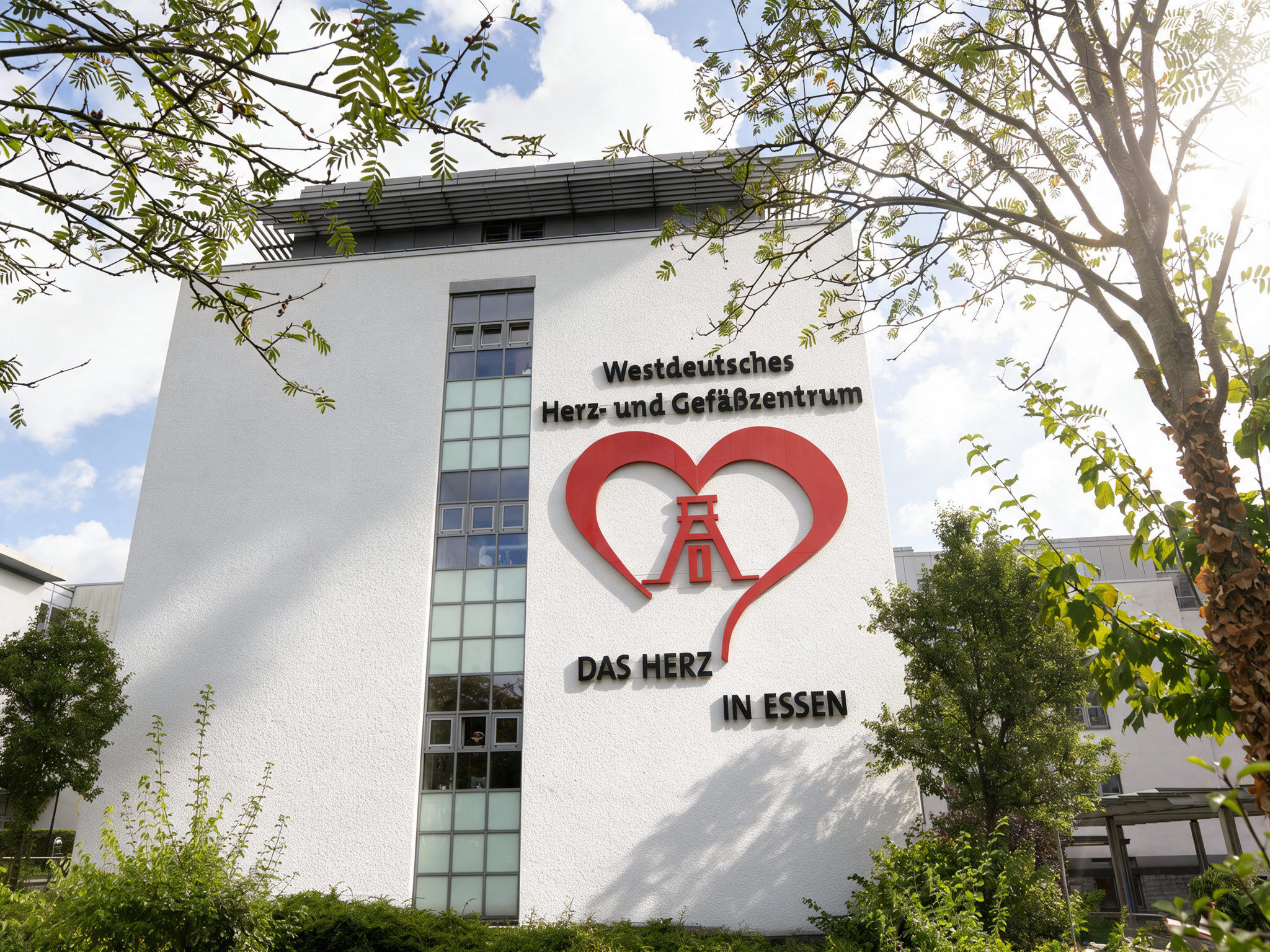 Herzmedizin der Zukunft: Universit&auml;tsmedizin  Essen b&uuml;ndelt Herzchirurgie am Campus - Titelbild